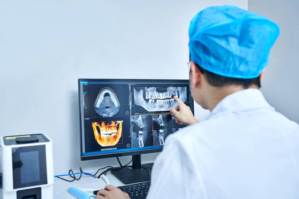 Best Emergency Dentist for Lost Fillings or Crowns in Mount Clemens, MI